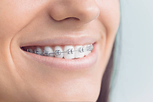 Full Mouth Reconstruction in Mcmurray, PA